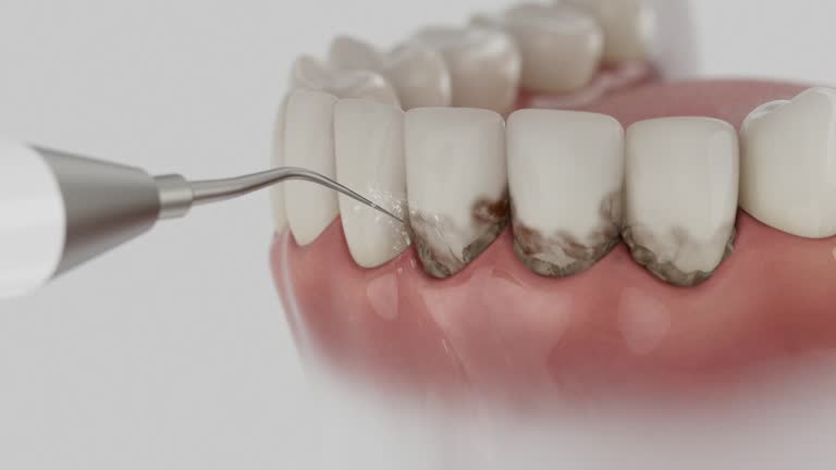 Reliable Tooth Extraction contractor in Morrow County County, OR by Dentist Open Now